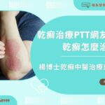 乾癬治療PTT網友嘆：乾癬怎麼治療？楊博士乾癬中醫治療來解答