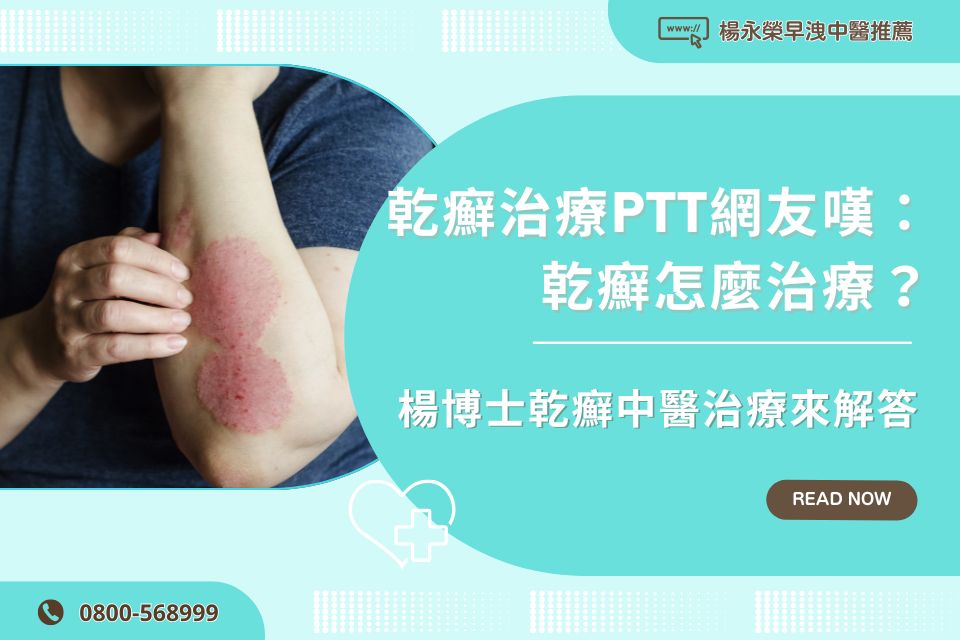 乾癬治療PTT網友嘆：乾癬怎麼治療？楊博士乾癬中醫治療來解答